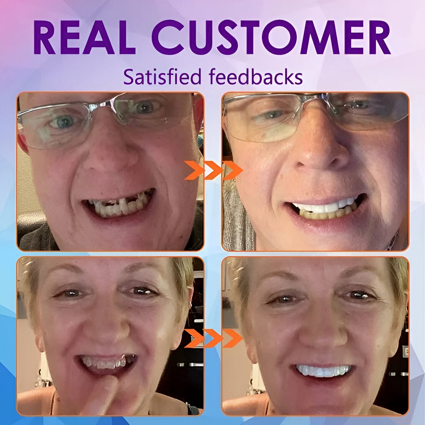 ComforaDent™ Denture Set