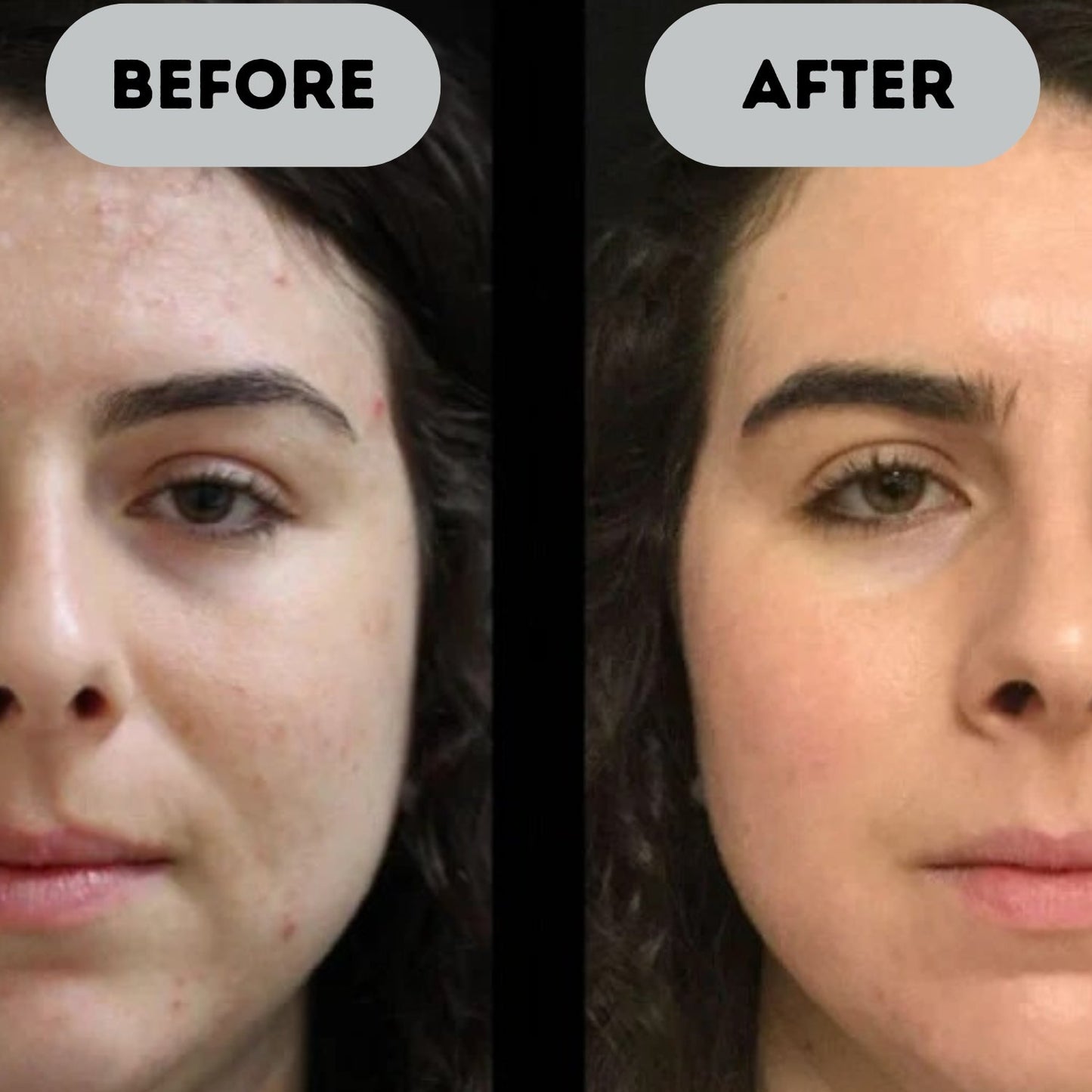 Dermura™ - Anti-Aging Booster Pro